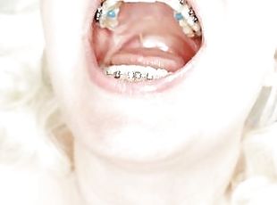 braces fetish: close up video mukbang 